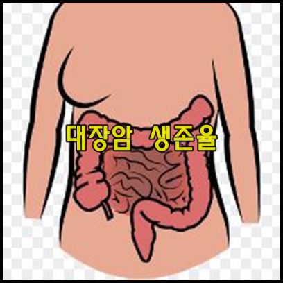 대장암 생존율