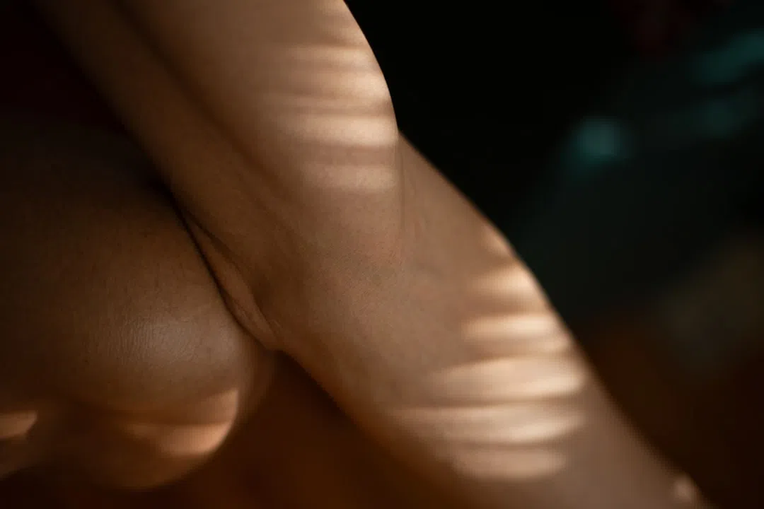 대상포진 통증- 피부이미지