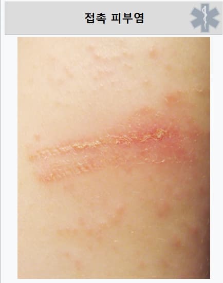 벤조산 부적합 건조기 시트 회수 명령 리스트