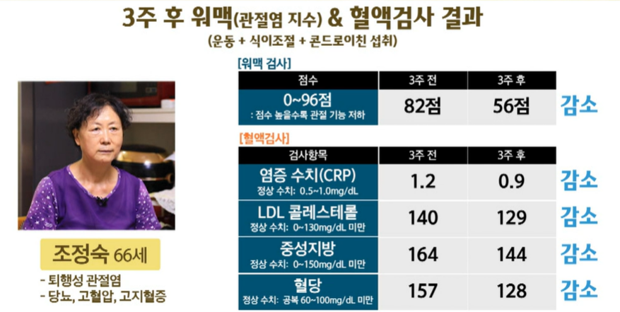 콘드로이친 효능