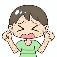 대상포진 초기증상 10가지