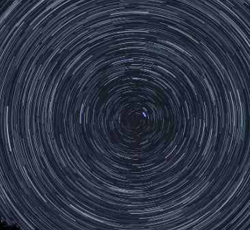 녹내장 초기증상 35