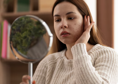 갑상선 기능 저하증 증상 16