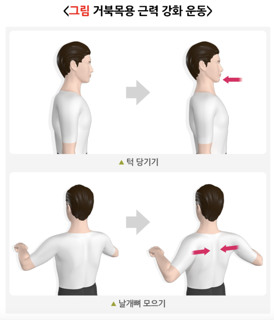 근력 강화 운동