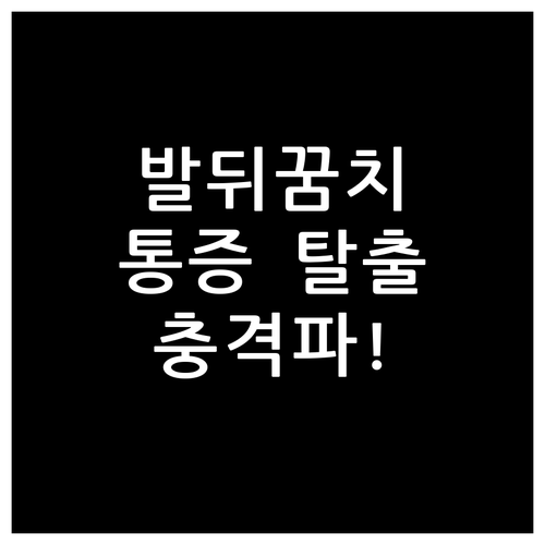 종골골극 진단 후 체외충격파 치료 효..