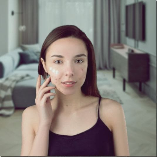 염증성 여드름이 심한 여성