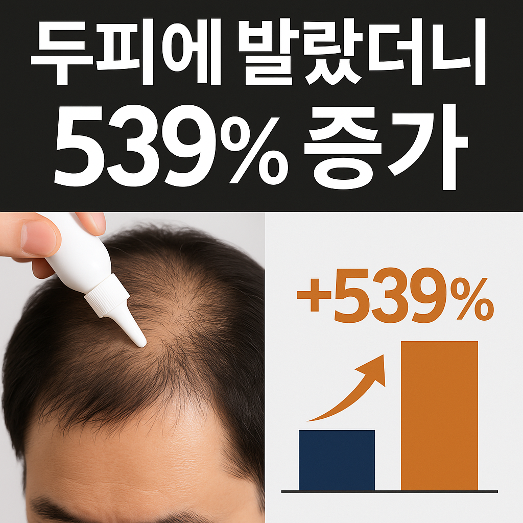 “두피에 바르는 탈모 치료제 효과를 강조한 뉴스형 썸네일로, 539% 모발 증가 그래프와 도포 장면이 포함된 이미지”