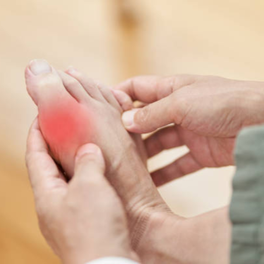 통풍 초기 증상