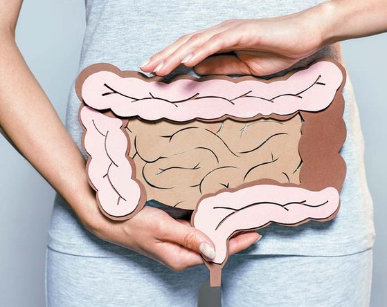 프로바이오틱스유산균/