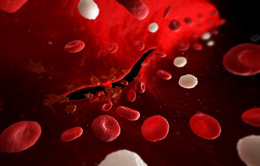 계피가루 효능4