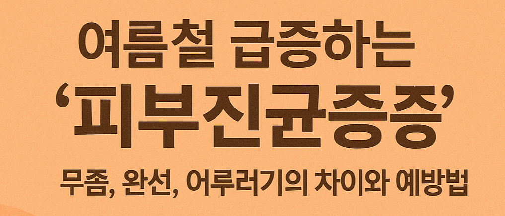 여름철 급증하는 피부진균증 – 무좀, 완선, 어루러기의 차이와 예방법
