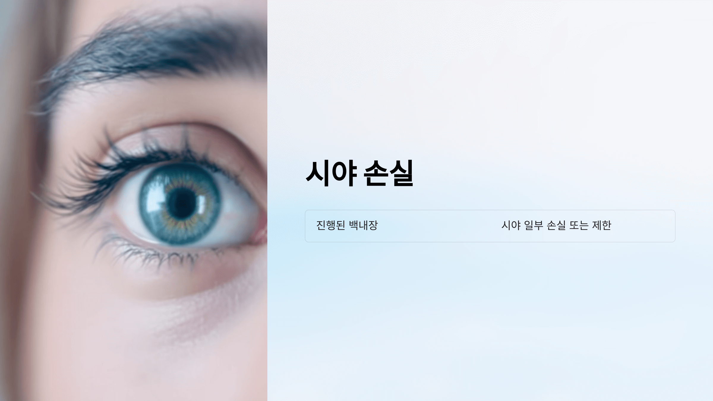 백내장과 관련된 사진입니다.