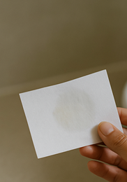 다낭성 난소증후군