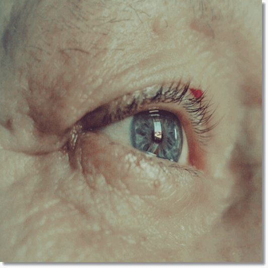 비문증 원인 및 증상과 합병증 예방과 치료