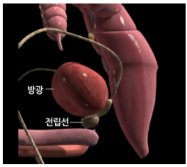 전립선사진