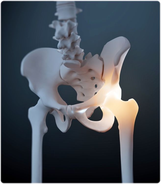 엉덩이 통증 원인