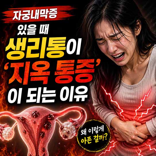 자궁내막증 있을 때 생리통이 &lsquo;지옥 통증&rsquo;이 되는 이유