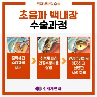 백내장 수술 비용 실비 보험 청구 회복기간_21