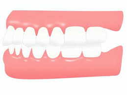 잇몸 염증 치료제 베스트 5