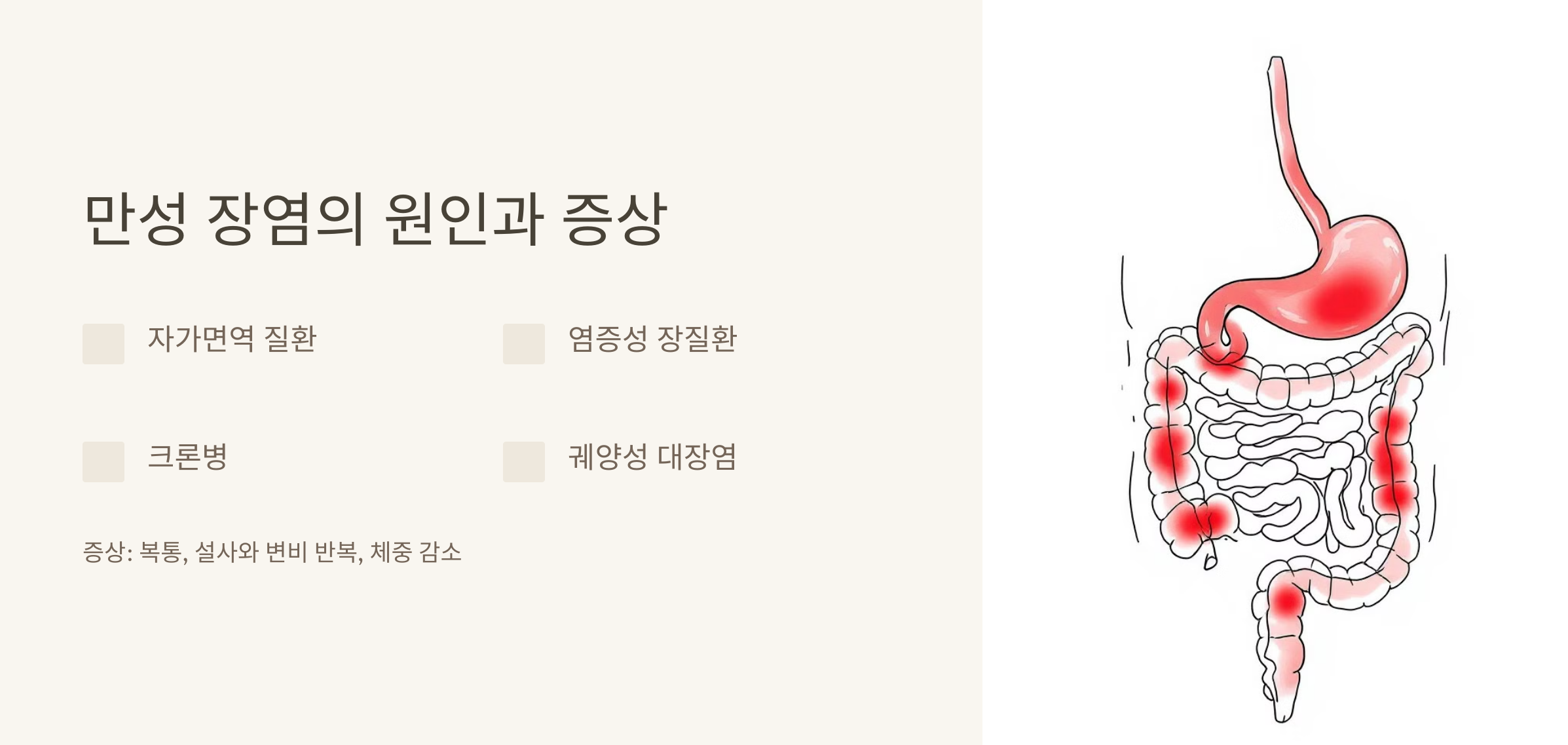 만성 장염 원인 증상 사진