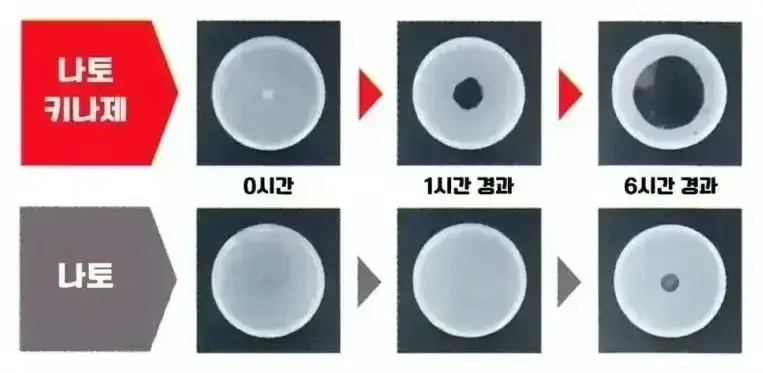 혈전용해제 나토키나제