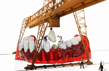 임플란트 가격에 영향을 미치는 요소