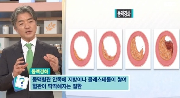 EBS명의-심혈관명의-김병극