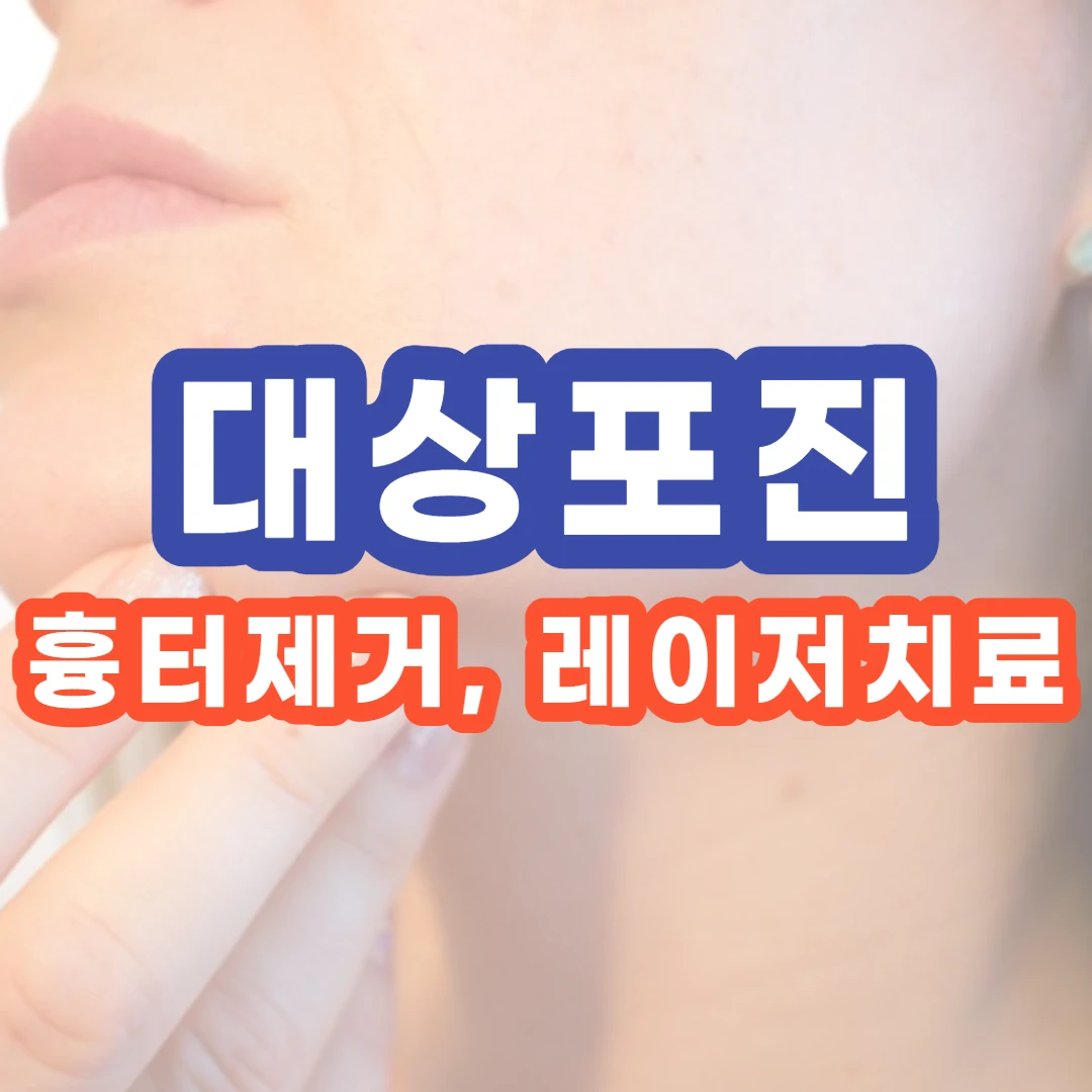 대상포진-흉터제거