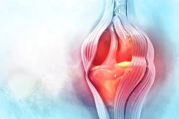 프로테오글리칸