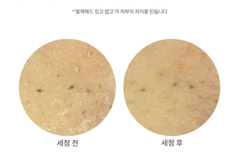 마녀공장 네고왕