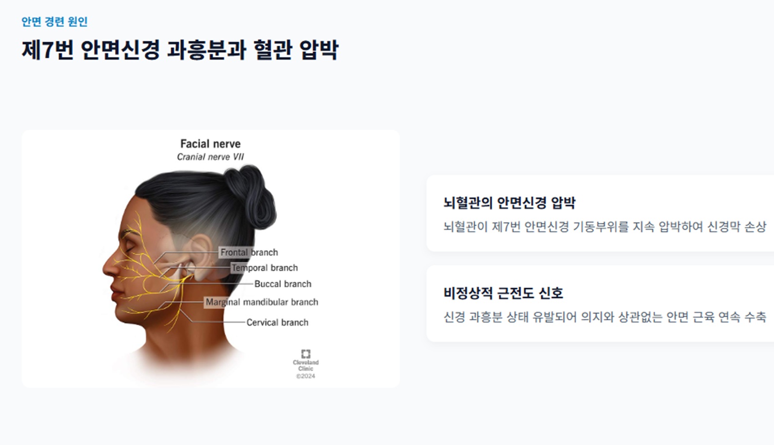안면신경-압박
