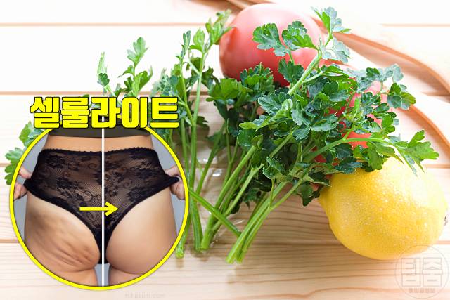 셀룰라이트 제거 음식 파슬리 셀룰라이트 없애는 음식