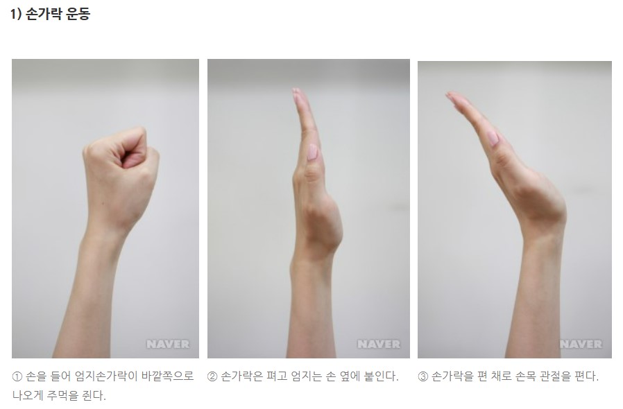 손목터널증후군 증상 원인 치료 방법