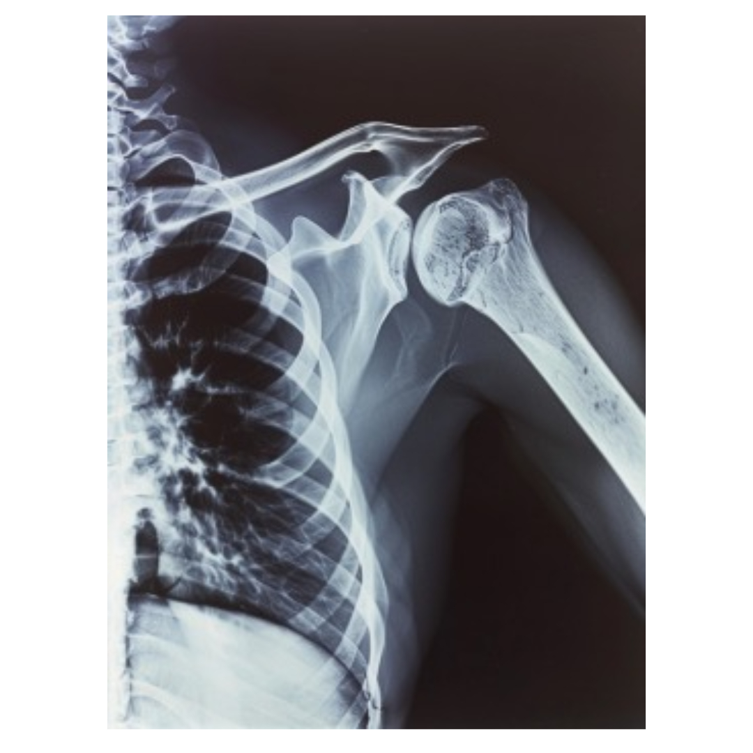 대장암과 관련된 사진입니다.