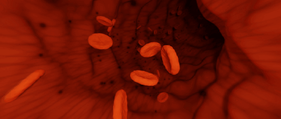 혈소판 정상수치