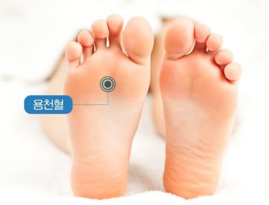 인체의 365혈 중에서 발바닥에 위치를 하고 있는 용천혈의 위치를 표시하고 있는 사진