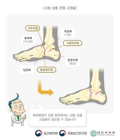 유전성 운동 및 감각 신경병증(HMSN, 샤르코-마리-투스병) 원인·증상·치료 총정리
