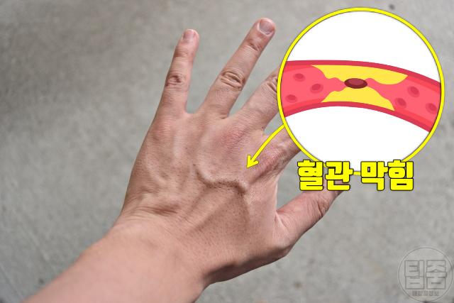 혈액순환영양제 추천 혈관에 좋은 음식