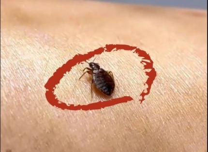 해외여행시 빈대 주의 특징 대처 방법 예방하기