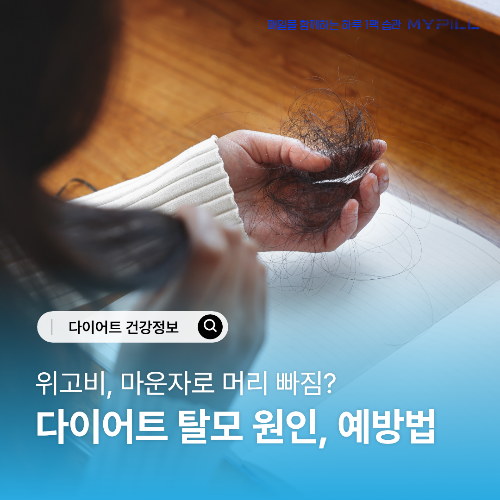 다이어트 탈모 원인, 예방방법