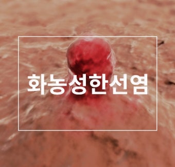 화농성 한선염 치료 수술 병원