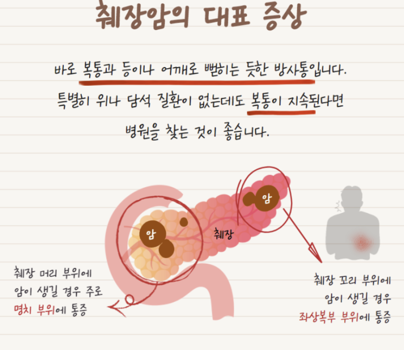 췌장암 초기증상 1