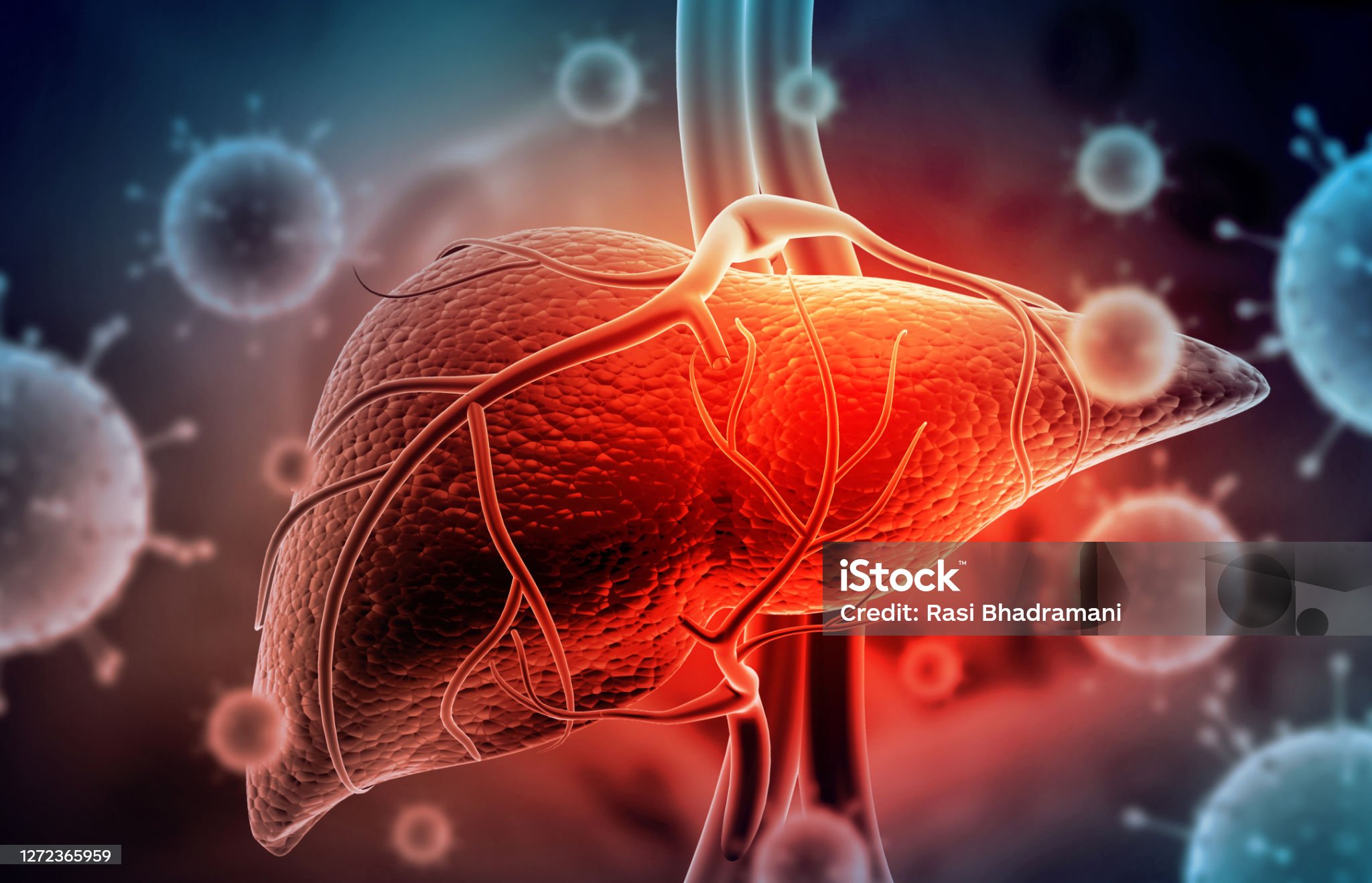 간경화-관련-사진
