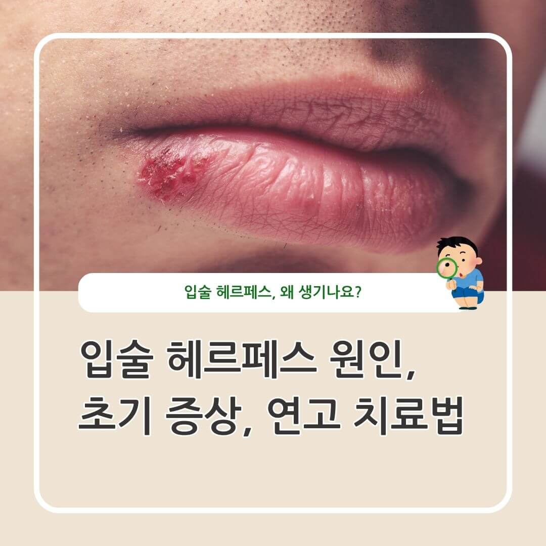 입술 헤르페스 증상