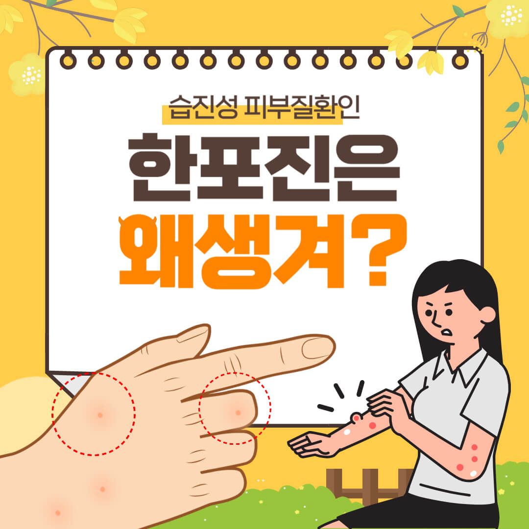 습진성 피부질환 한포진 발생이유