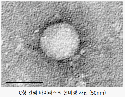 C형 간염 이미지사진