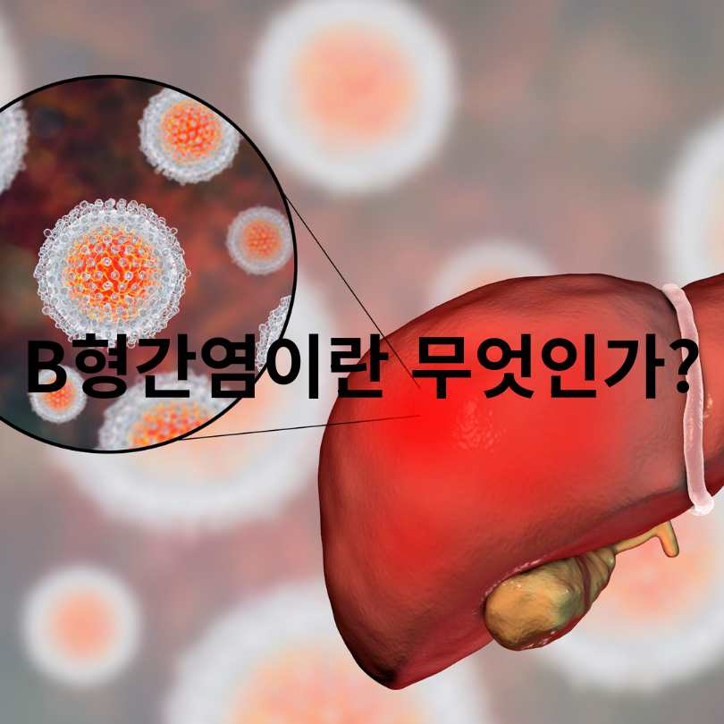 B형간염 보균자와 보유자의 차이