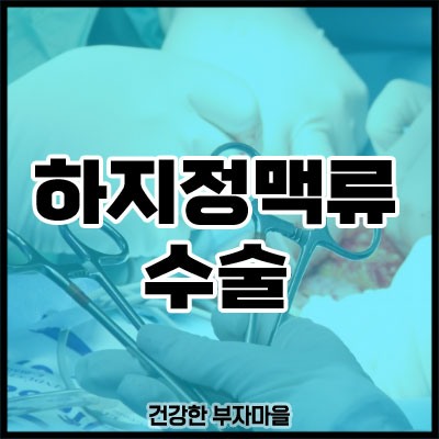 하지정맥류 수술