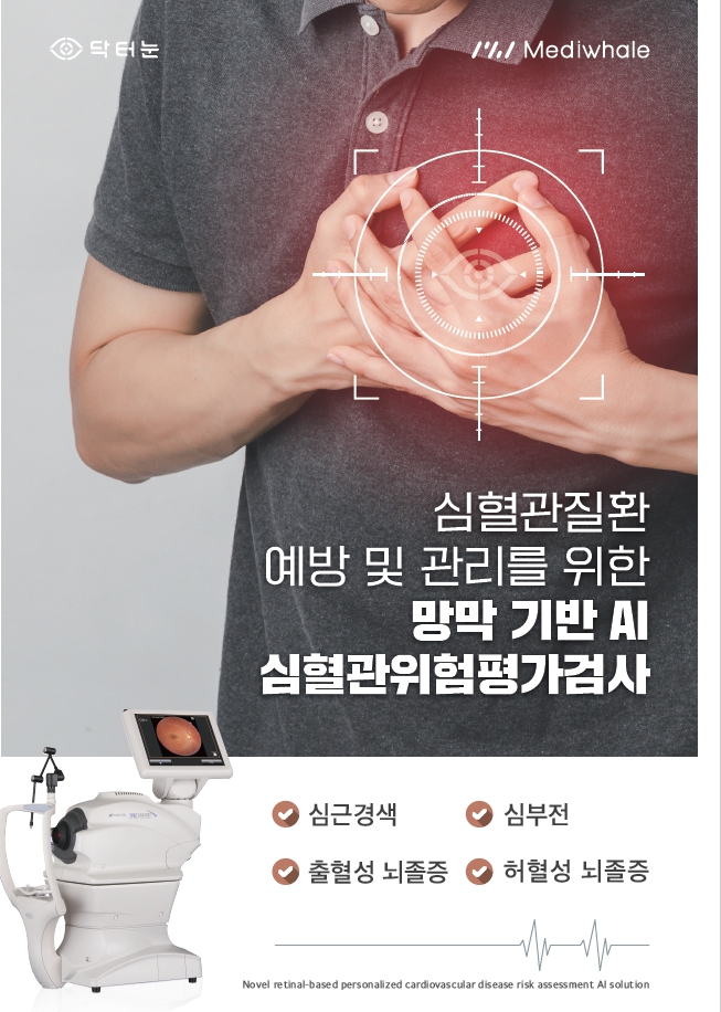 안저검사도 이제 AI 판독