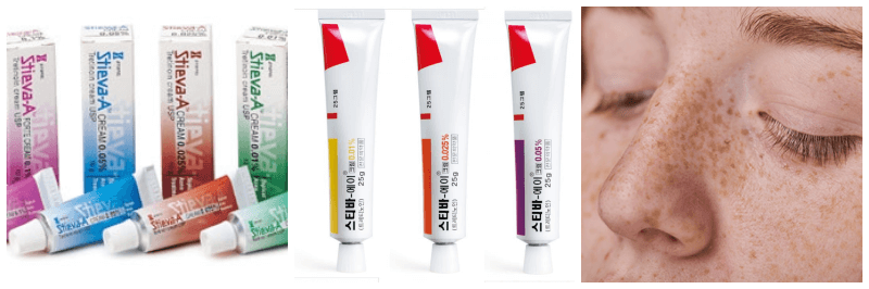 스티바 A크림, 주근깨 사진